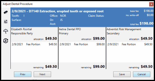 Adjust procedure window
