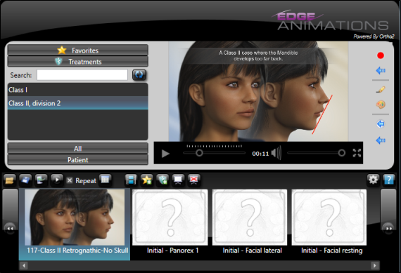 Edge Animations Overview