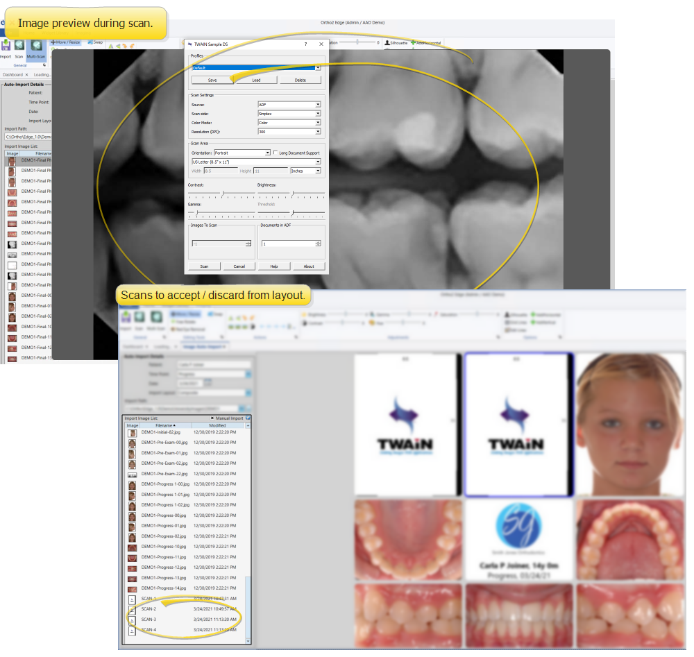 Auto-import scan preview