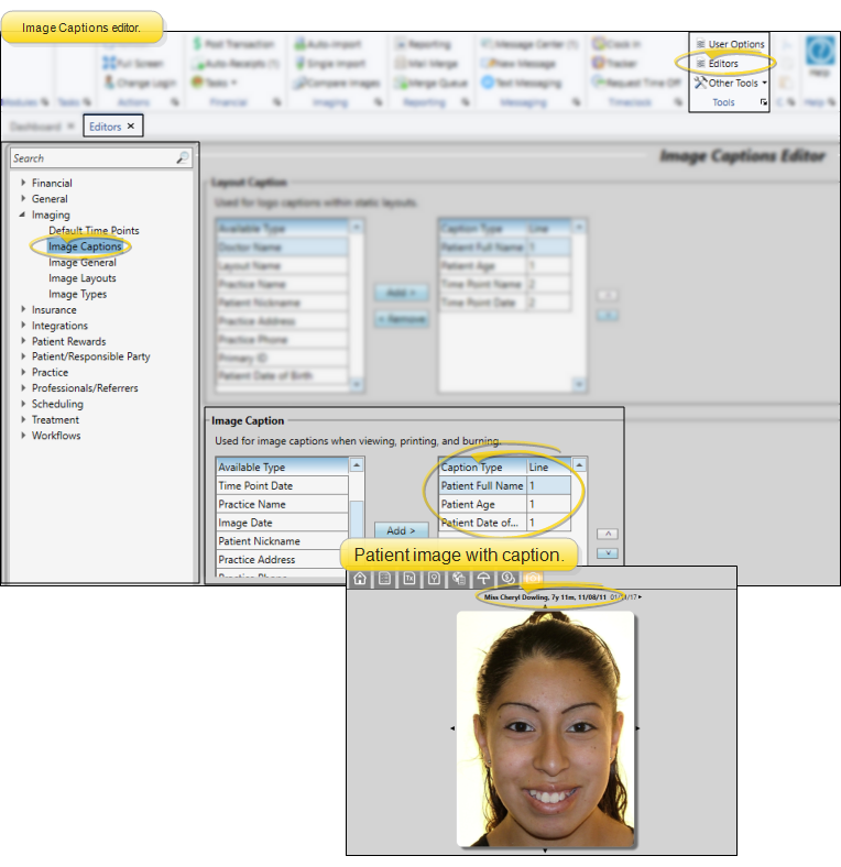 Image caption editor
